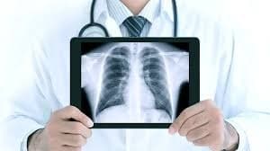 Digital X-ray